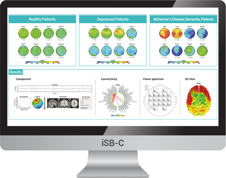 🧠 QEEG LÀ GÌ? VÌ SAO ĐO NÃO NHƯNG KHÔNG PHẢI AI CŨNG HIỂU ĐƯỢC NÃO?