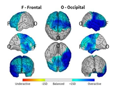 🧠 TIC – LO ÂU – NGHIỆN MẠNG XÃ HỘI – STRESS - MẤT NGỦ