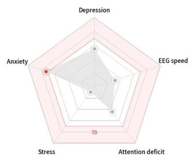 🧠 CÔNG NGHỆ MỚI CỦA MŨ ĐO ĐIỆN NÃO ĐỒ AI: PHÂN TÍCH 5 CHỈ SỐ BẰNG SÓNG NÃO – HIỂU RÕ TÌNH TRẠNG NÃO BỘ CỦA BẠN