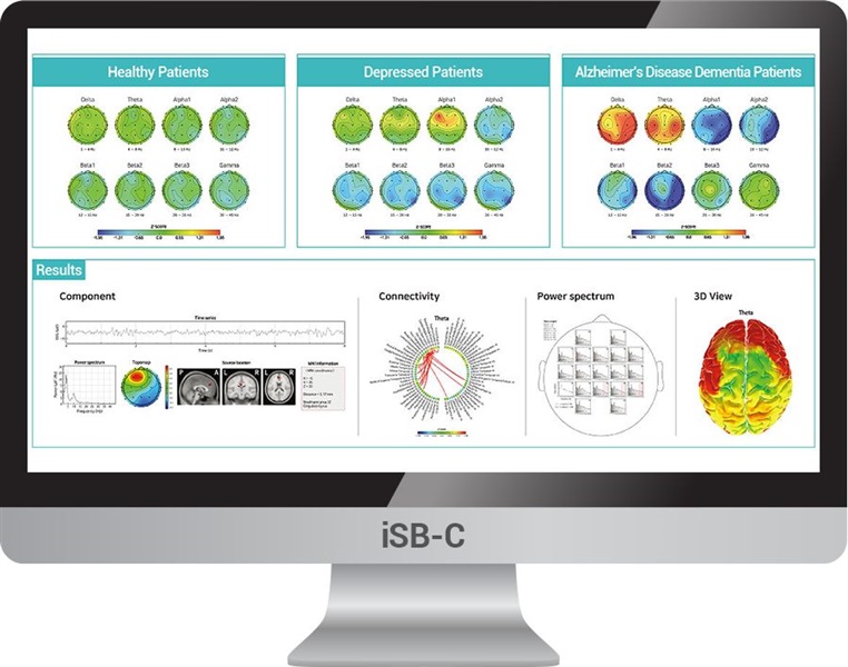 🧠 QEEG – BƯỚC TIẾN QUAN TRỌNG GIÚP “NHÌN THẤY” HOẠT ĐỘNG NÃO BỘ TRONG Y HỌC