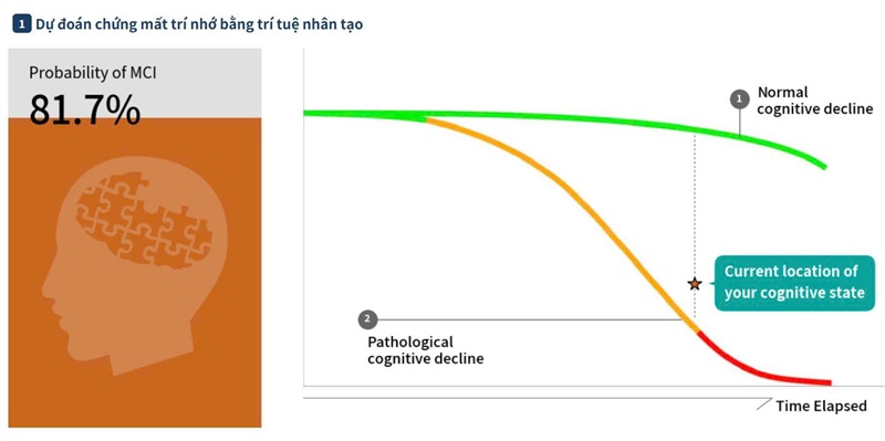 🧠 CÔNG NGHỆ MỚI CÓ THỂ CHẨN ĐOÁN SUY GIẢM TRÍ NHỚ & SÀNG LỌC aMCI TỪ RẤT SỚM